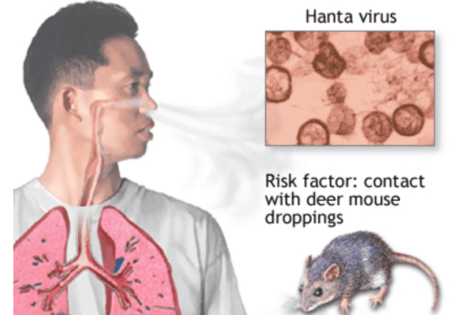 Hantavirus